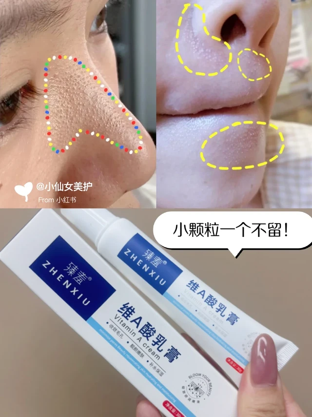 密密麻麻小颗粒！花小钱💰轻松解决❗️