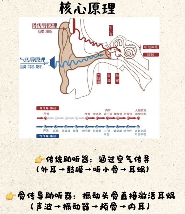 选气传导还是骨传导？四款助听器测评：未来客骨传导怎么样？