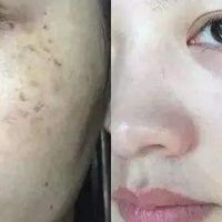 美白祛斑霜效果最好的排名第一,多维狙击:抗皱美白淡斑护肤品推荐