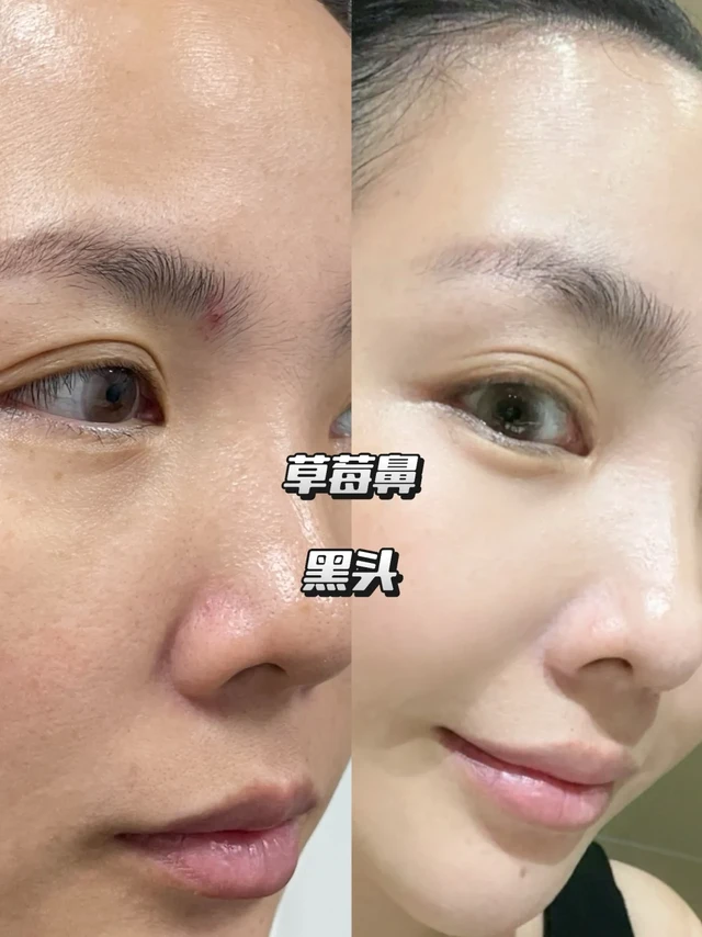 这洗面奶我愿称为油痘人天菜。。。。