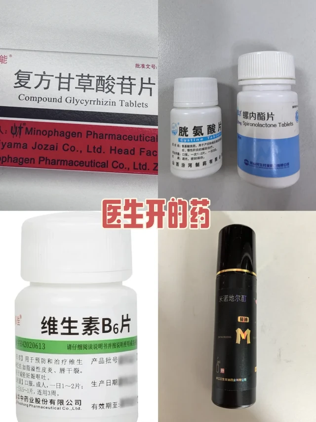 脂溢性脱发︱我靠吃药防脱+米诺生发 上岸