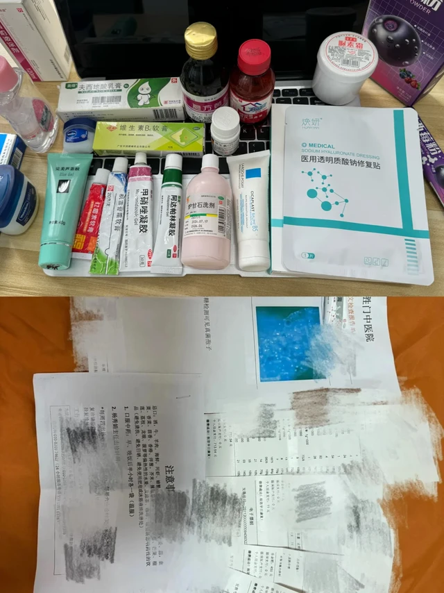 六年重度痤疮患者治疗➕抗炎详细自述！
