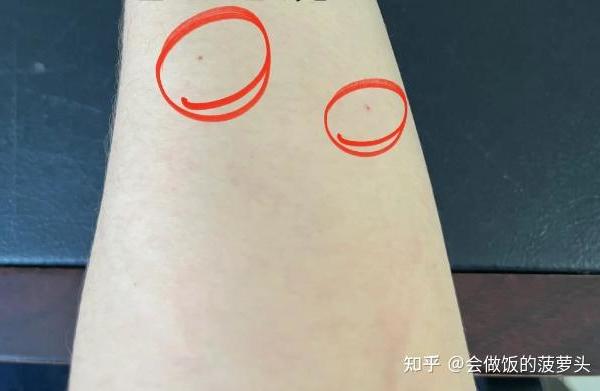 （最新版）自用近一年真实揭秘护肝片到底是不是智商税？MitoQ/Swisse/汤臣倍健/Wonderlab哪个牌子好？和普通护肝片有什么区别？