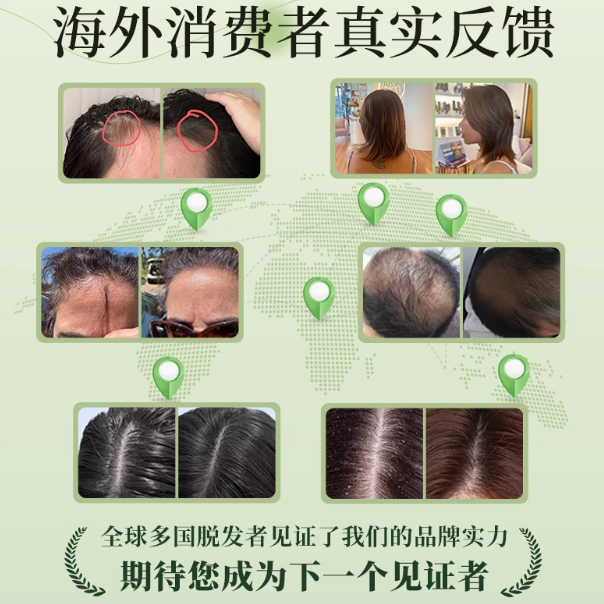 ACANLUX 安植丽洗发水：头发问题的全方位解决方案