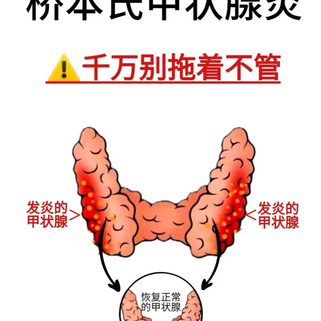 小蝴蝶受损，生育损伤远不止漏尿、妊娠纹、刀疤那么简单！