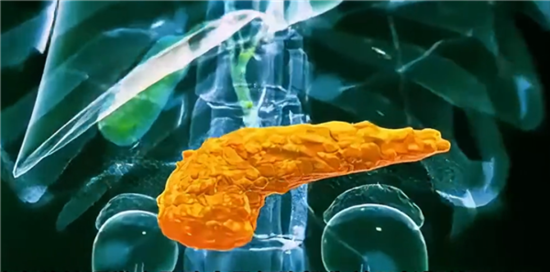糖尿病突破!科学家成功3D打印全功能人类胰岛