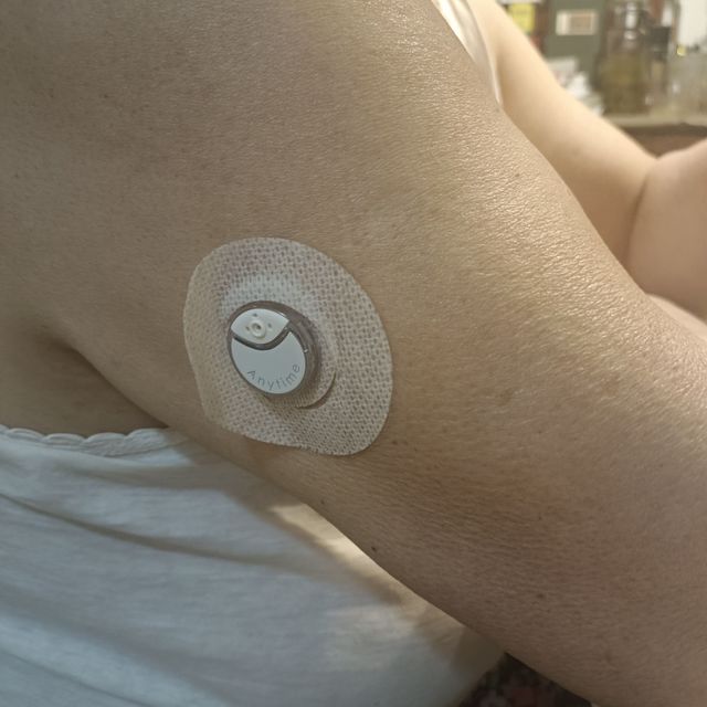 不用每天扎手指了！120元购入鱼跃安耐糖5代动态血糖仪使用感受
