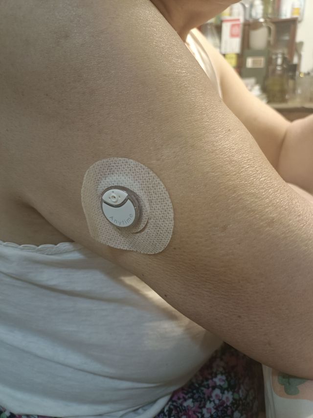 不用每天扎手指了！120元购入鱼跃安耐糖5代动态血糖仪使用感受