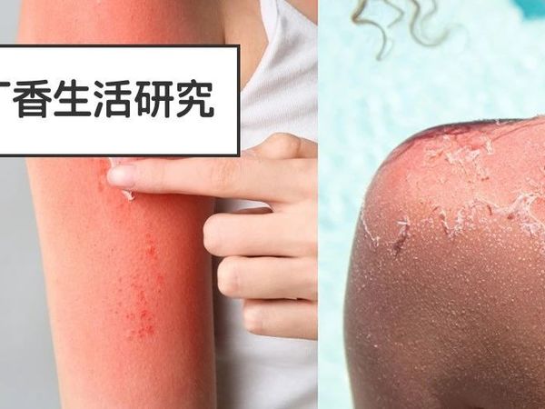 以为没事，实则会晒黑晒伤的 5 个行为！很多人第一个就中招