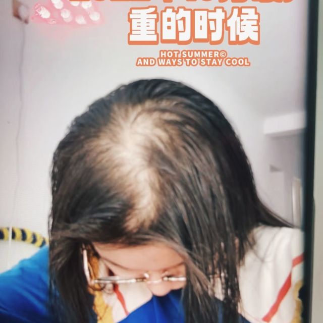 做好这些，头发长出来了