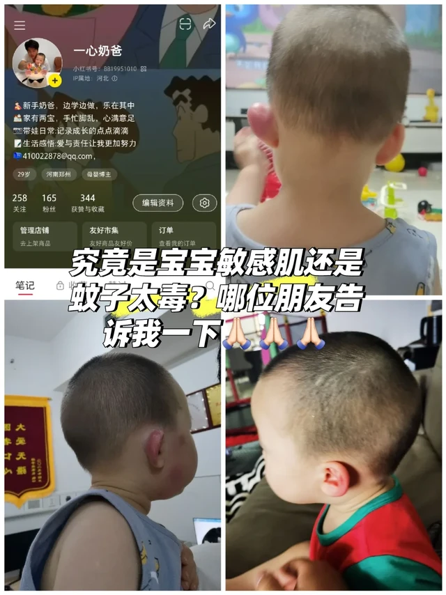 暑期的宝宝：敏感肌？？？？