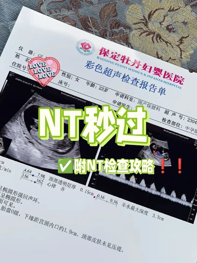 产检一路绿灯✅｜NT秒过你接不接～