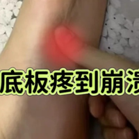 足底筋膜炎康复血泪史，我都做了哪些自救？