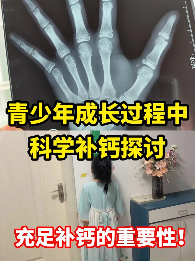 青少年成长过程中科学补钙探讨