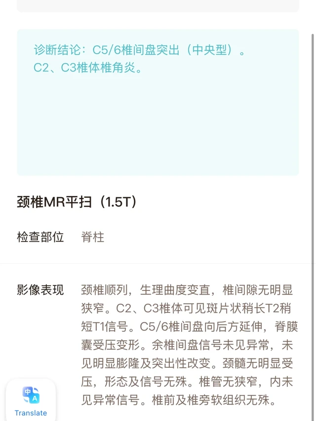 头晕真相了…是脊椎病🤯