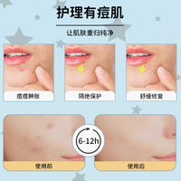 AUSLKA Beauty 60 贴星星痘痘贴：痘痘肌的贴心救星