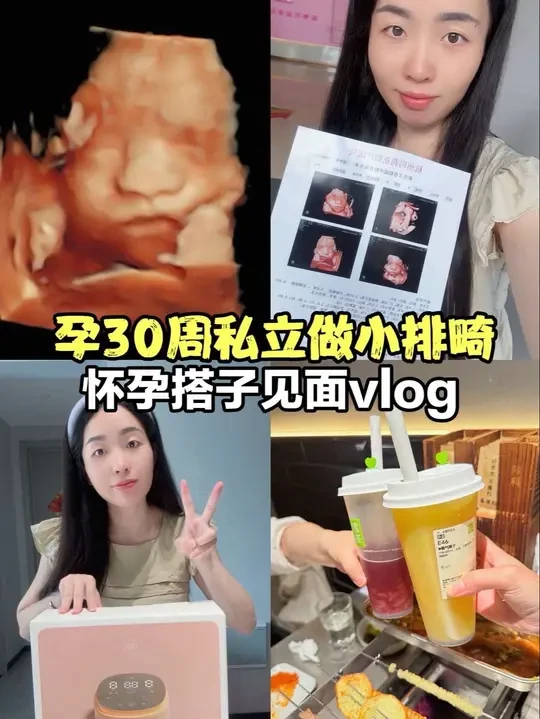 孕30周+，小排畸已做，宝宝口粮已安排妥当，怀孕搭子也见了，充实的一天！#vlog日常 #孕晚期 #新贝吸奶器#四维彩超 #小排畸顺利通过