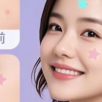 痘痘贴：五角星星遮瑕贴