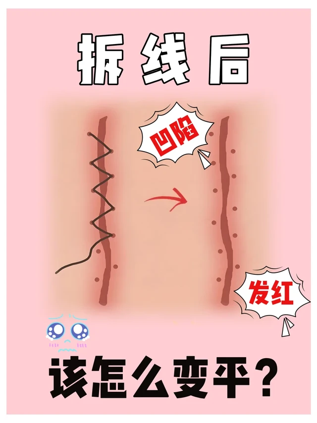 拆线后凹陷发红？教你抚平肌肤新招