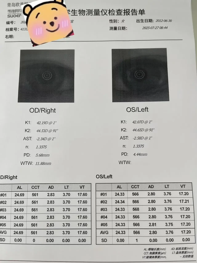 案例分析。🔥13岁欧普小会员1年近视度数0增长!真实案例分享
24年8月份家长果断给孩子换了蔡司小乐圆1.6H,结果太惊喜了!👏
✅ 右眼眼轴回退0.12mm
✅ 左眼仅增长0.08mm(几乎可