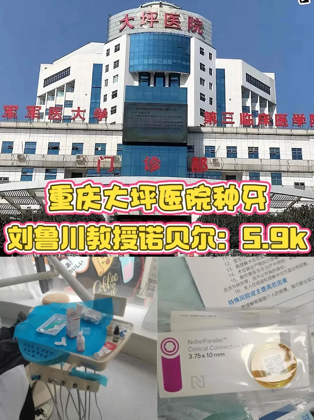 重庆大坪医院教授种牙：诺贝尔5.9k