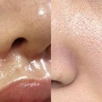 不同肤质该如何选洗面奶？