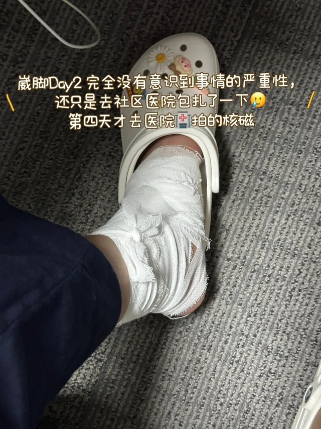 🦶🏻崴脚实录|距腓前韧带断裂保守治疗