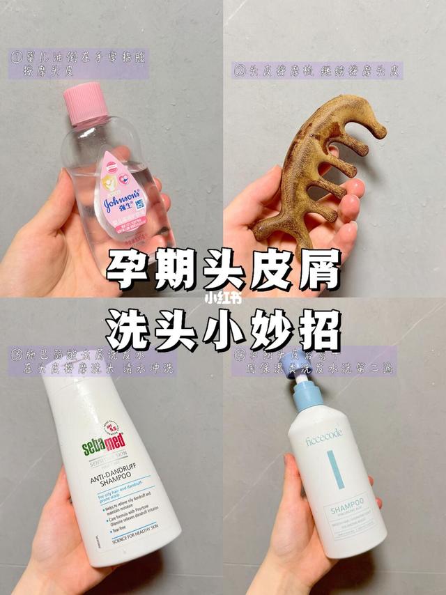 🚿21周小孕妇的孕期头皮屑洗头小妙招✨