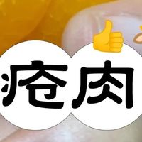 痔疮肉球疼痛难忍？照着做，被痔疮肉球折磨的日子一去不返！