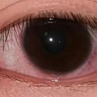 中医：用眼过度，这样养回来