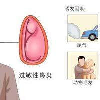 立秋过敏性鼻炎高发期：从鼻腔护理到科学用药的全面防护指南