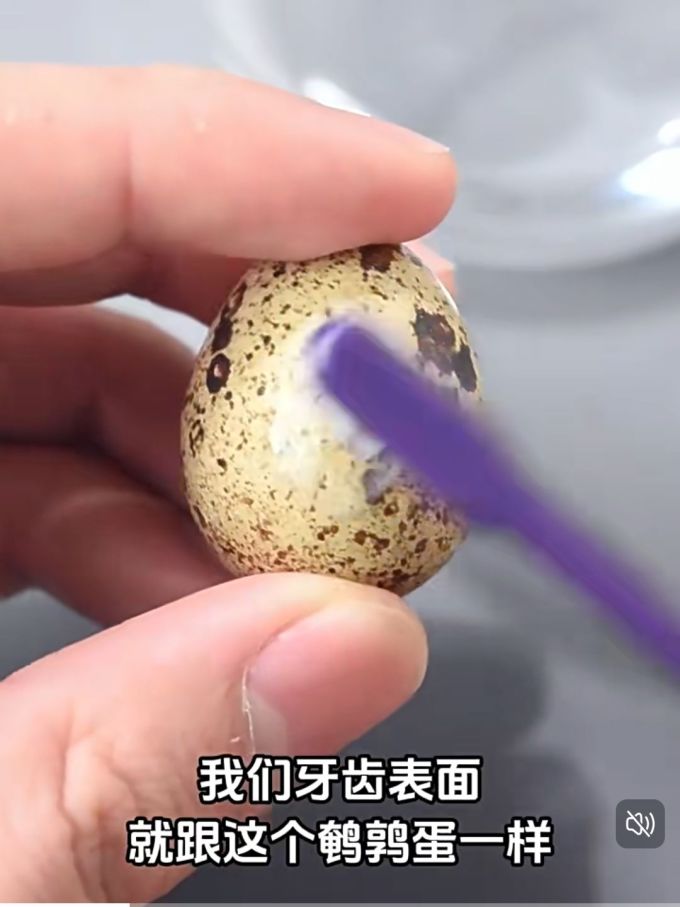 口腔护理