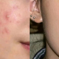 痘肌早餐|8吃8不吃！！养成无痘肌从早餐开始努力！