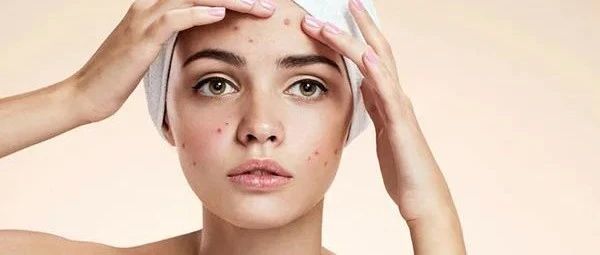 众多医生推荐的红肿痘痘救星，究竟有什么过人之处，一文深扒夫西地酸乳膏的抗痘真相！