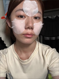 油痘肌救星！水杨酸棉片擦出鸡蛋肌，闭口全平了