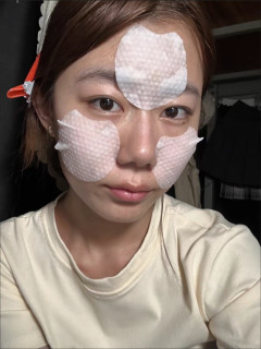 油痘肌救星！水杨酸棉片擦出鸡蛋肌，闭口全平了