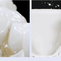 健康保护 篇零：冲牙器哪个品牌好用？揭秘十款年度优秀品牌，公开真实数据