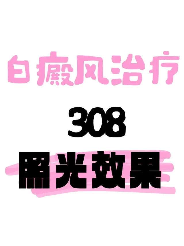 308照灯全记录｜我的白癜风光疗真实体验