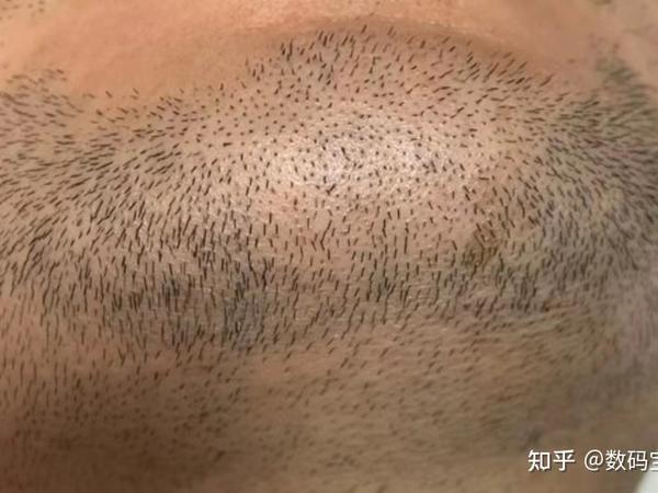 剃须刀怎么选?残留胡茬、剃不干净、刮完皮肤又红又肿?为什么现在很多电动剃须刀这么不好用?徕芬、有色、米家、飞科、博朗2025最新旗舰型号表现到底如何?