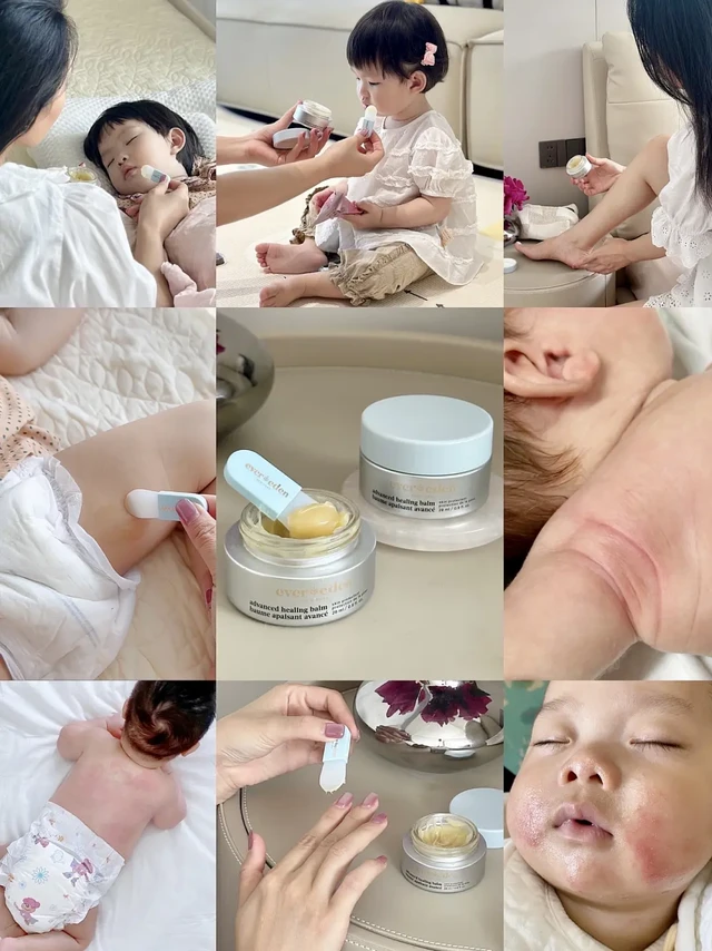 我敢说90%的妈妈都不会用evereden万用膏