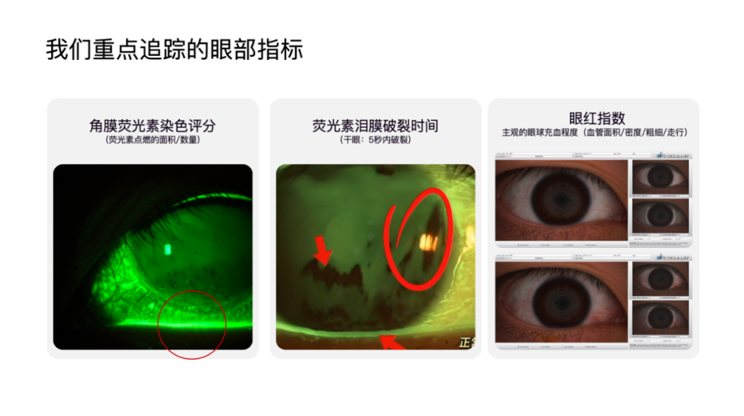不止爸妈,手机厂商怎么也开始关心你的用眼健康了?