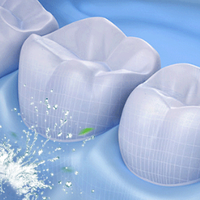 便携式冲牙器哪个牌子好？五大机型实测，教你儿童款怎么选