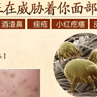 床上除螨仪真的有用吗？是不是智商税？2025高性价比除螨仪推荐