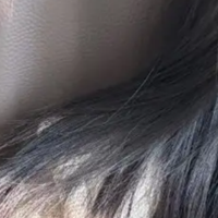 上班族总是掉很多头发，应该怎么做头皮养护？