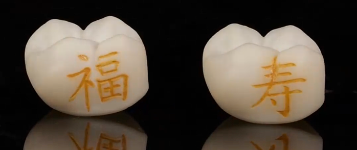牙上纹身？牙冠刻印风靡齿科，正规医生不建议