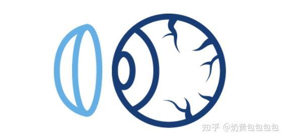 隐形眼镜在网上买安全吗知乎推荐
