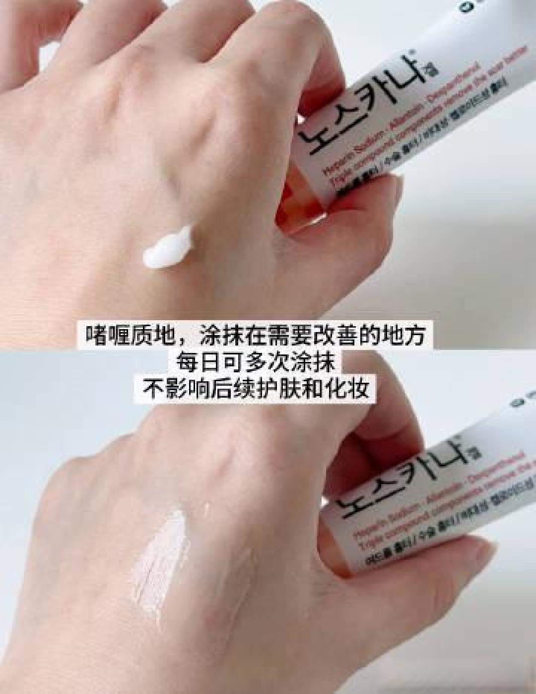 祛疤膏真的有效?科学解析疤痕修复黄金期与成分选择