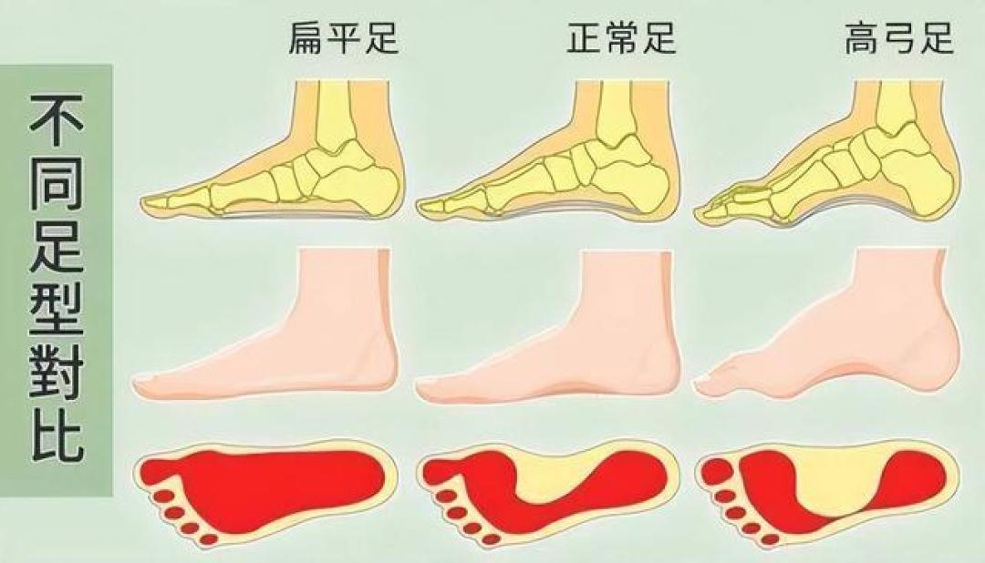 这六个手法彻底释放你的足底筋膜，让你“足”够轻松！