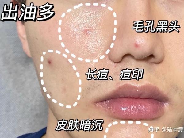 2025男士洗面奶推荐 | 男士洗面奶段位榜 | 持久控油、深层洁面、去黄提亮男士洗面奶！！！