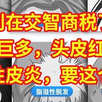 溢脂性皮炎、头皮屑巨多，花了几千学费，才知道18元就可以治疗